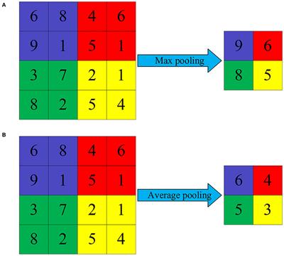 Early Prediction of Refractory Epilepsy in Children Under Artificial Intelligence Neural Network